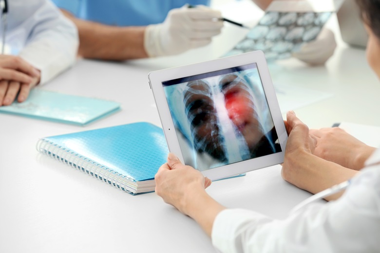 Lab person examine X-ray by ThinkLab Teleradiology software